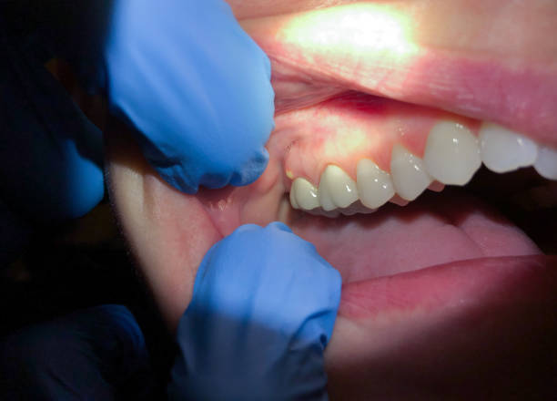 Best Broken or Chipped Tooth Repair in Tappahannock, VA